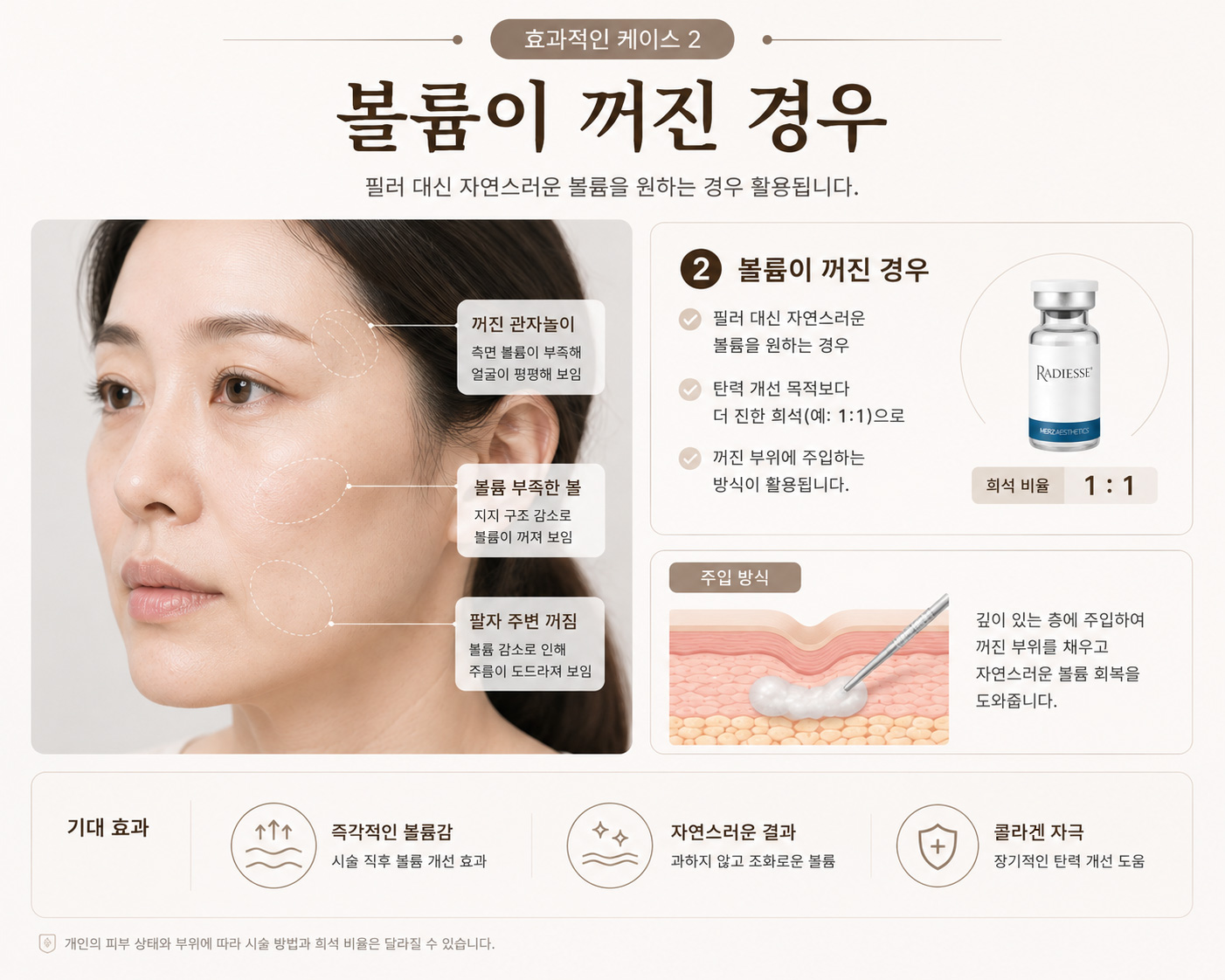 260813_효과_볼륨.jpg